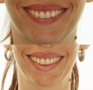 062174c7-7fef-452b-9876-9e82ab33abc2